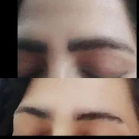 لیزرتتولیزر ابرو.ریموو.پاکسازی تتوبا لیزرکیوسوییچ|خدمات آرایشگری و زیبایی|تهران, تهرانسر شرقی|دیوار