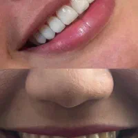 دندانسازی و کامپوزیت زیبایی