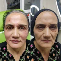 تخفیف پاییزی ژل و بوتاکس نتایج طبیعی و حرفه ای|خدمات آرایشگری و زیبایی|تهران, میرداماد|دیوار