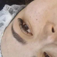 ترمیم و اکسیشن مژه و لیفت ابرو و مژه