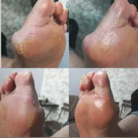 پدیکور و کف سابی کف پا|خدمات آرایشگری و زیبایی|آمل, |دیوار