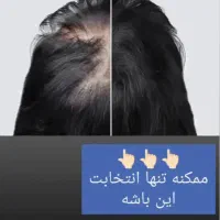 درمان ریشه ای ریزشمو،تقویت ورشدمجددموها|آرایشی، بهداشتی، درمانی|مینودشت, |دیوار