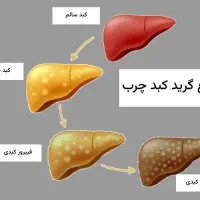 *درمان. کبدچرب|آرایشی، بهداشتی، درمانی|اصفهان, عباسآباد|دیوار