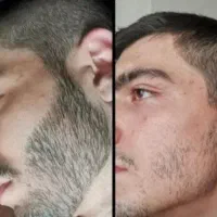 سرم رشد. طبیعی. مو. و ریش. با ۱دوره