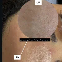 فیشال تخصصی و درمانی با برند کلینیکی کره جنوبی|خدمات آرایشگری و زیبایی|بندر کنگان, |دیوار