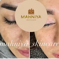 فیشال،آلگاپیل(پوست مار)هایفوتراپی،پوست کره ای|خدمات آرایشگری و زیبایی|قم, دورشهر|دیوار