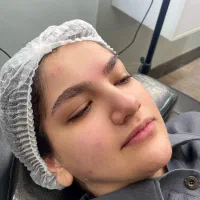 مدل میکرو و شیدینگ لب