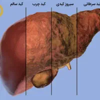 پاک سازی کبد با روش طب سنتی