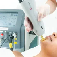 اپراتور لیزر مو خانم