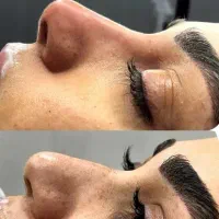 ژل لب فیلر بوتاکس پی ار پی فیلر گونه خط خنده|خدمات آرایشگری و زیبایی|کاشان, طالقانی|دیوار