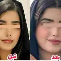 پودر جوانه گندم برای چاقی و تپلی صورت|آرایشی، بهداشتی، درمانی|لاهیجان, امیرشهید|دیوار