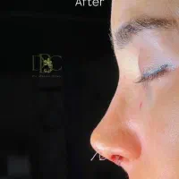 جراحی زیبایی بینی در تهران۳۶تومن