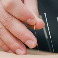 طب سنتی زالو درمانی طب سوزنی شکسته بندی ماساژ