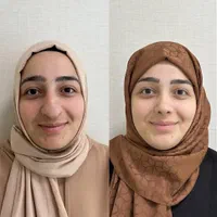 جراحی عمل بینی ۲۴ میلیونی/رینوپلاستی/بینی فانتزی|خدمات آرایشگری و زیبایی|تهران, مطهری|دیوار