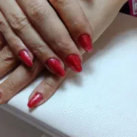 انواع کاشت وطراحی