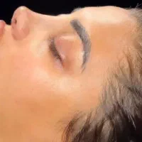 عمل جراحی زیبایی بینی،ترمیم بینی،صورت،اندام|خدمات زیبایی و سلامت|تهران, تهرانپارس غربی|دیوار