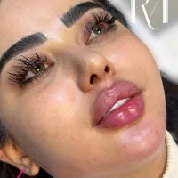 خدمات ژل و‌بوتاکس در(مطب)