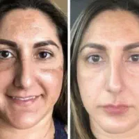 کرم وی ای پی سفیدکننده پنبه ای خداشاهداصل|آرایشی، بهداشتی، درمانی|مرودشت, ژیان|دیوار