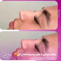 جشنوار تابستانه ژل و بوتاکس و شرایط اقساطی|خدمات آرایشگری و زیبایی|آمل, |دیوار