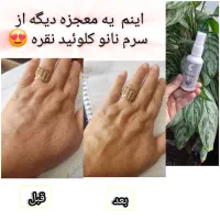 تونیک نانو نقره از محصولات سلامتی و مراقبت  اریا|آرایشی، بهداشتی، درمانی|قرچک, مهدیه|دیوار