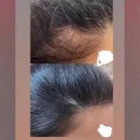 درمان تمامی بیماری های پوست و مو