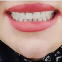 دندانسازی ساخت دندان مصنوعی