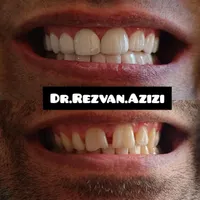 دیگر نگران هزینه‌های سنگین خدمات دندانپزشکی نباشید|خدمات آرایشگری و زیبایی|شیراز, ملاصدرا|دیوار