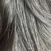 پاکسازی تضمینی  شپش موی سر (رفع دائمی تضمینی)
