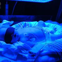 اجاره دستگاه زردی نوزاد ۴ لامپه