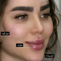 ساکشن غبغب شکم پهلو|خدمات آرایشگری و زیبایی|شیراز, عفیف‌آباد|دیوار
