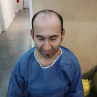 کلینیک کاشت مو