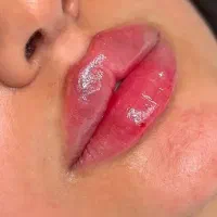 ژل و بوتاکس و پیرسینگ|خدمات آرایشگری و زیبایی|مشهد, خواجه ربیع|دیوار