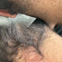 با یک جلسه کک و مکا حذف کن|خدمات آرایشگری و زیبایی|خرم‌آباد, |دیوار