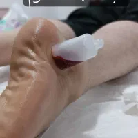 آموزش دوره تخصصی حجامت فصد زالو بادکش|خدمات آموزشی|کرج, کمال‌شهر|دیوار