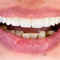 کلینیک دندانپزشکی رز|خدمات آرایشگری و زیبایی|کرمان, |دیوار