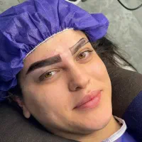 کاشت ابرو فقط۱۲میلیون