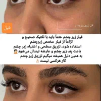 جشنواره/فیلر/بوتاکس/آنزیم/تخفیف دکترفیروزی|خدمات آرایشگری و زیبایی|شیراز, زرهی|دیوار