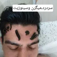 طب سوزنی بادکش گرم مشاوره تغذیه حجامت عام زالو