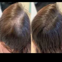 خدمات تخصصی صورت