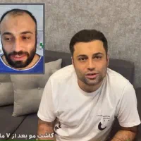 کاشت مو با تراکم بالا فقط با ۸ میلیون پیش‌پرداخت|خدمات آرایشگری و زیبایی|تهران, جردن|دیوار