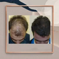 تزریق اعتماد به نفس