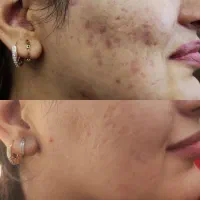 متخصص پوست و موهمراه مشاوره‌  وروتین پیشنهاد محصول|خدمات آرایشگری و زیبایی|اردبیل, |دیوار