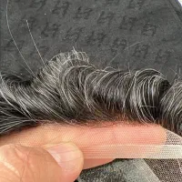 پروتز مو و ترمیم مو