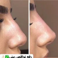 اصلاح فرم بینی باتزریق فیلربدون جراحی باقیمت عالی|خدمات آرایشگری و زیبایی|اصفهان, وحید|دیوار
