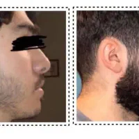 معجزه رویش ریش