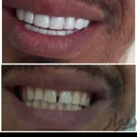 برطرف کردن تمام عیوب دندان|آرایشی، بهداشتی، درمانی|سیرجان, |دیوار