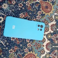 mi 11 lite 5G شیائومی در حد