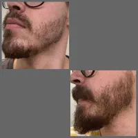ریش و مو|آرایشی، بهداشتی، درمانی|تربتحیدریه, مسجد جامع|دیوار