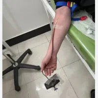 فصد خون تخصصی در منزل