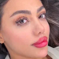 مدل میکروبلیدینگ